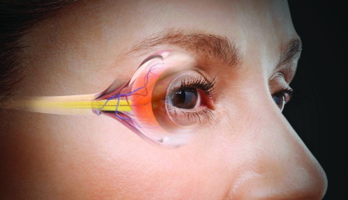 Eye Issu Top Causes of Eye Problems – Qi Supplements
